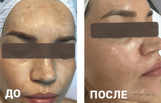 ВОТ ТАКИЕ РЕЗУЛЬТАТЫ У МОИХ КЛИЕНТОК